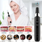 Rechargeable Dental Calculus Remover Teeth Cleaning Device