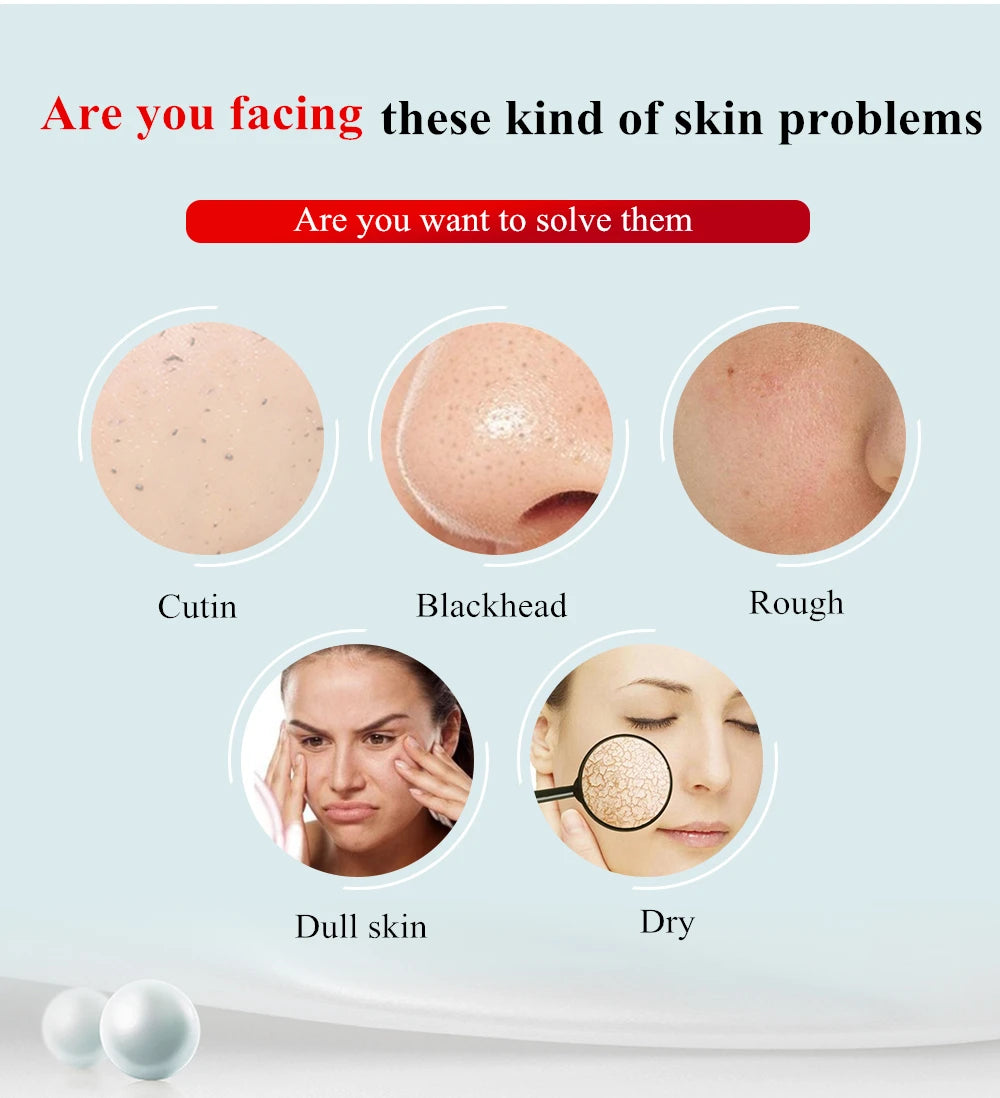 3-in-1 Diamond Microdermabrasion Vacuum Machine for Home Facial Skin Rejuvenation
