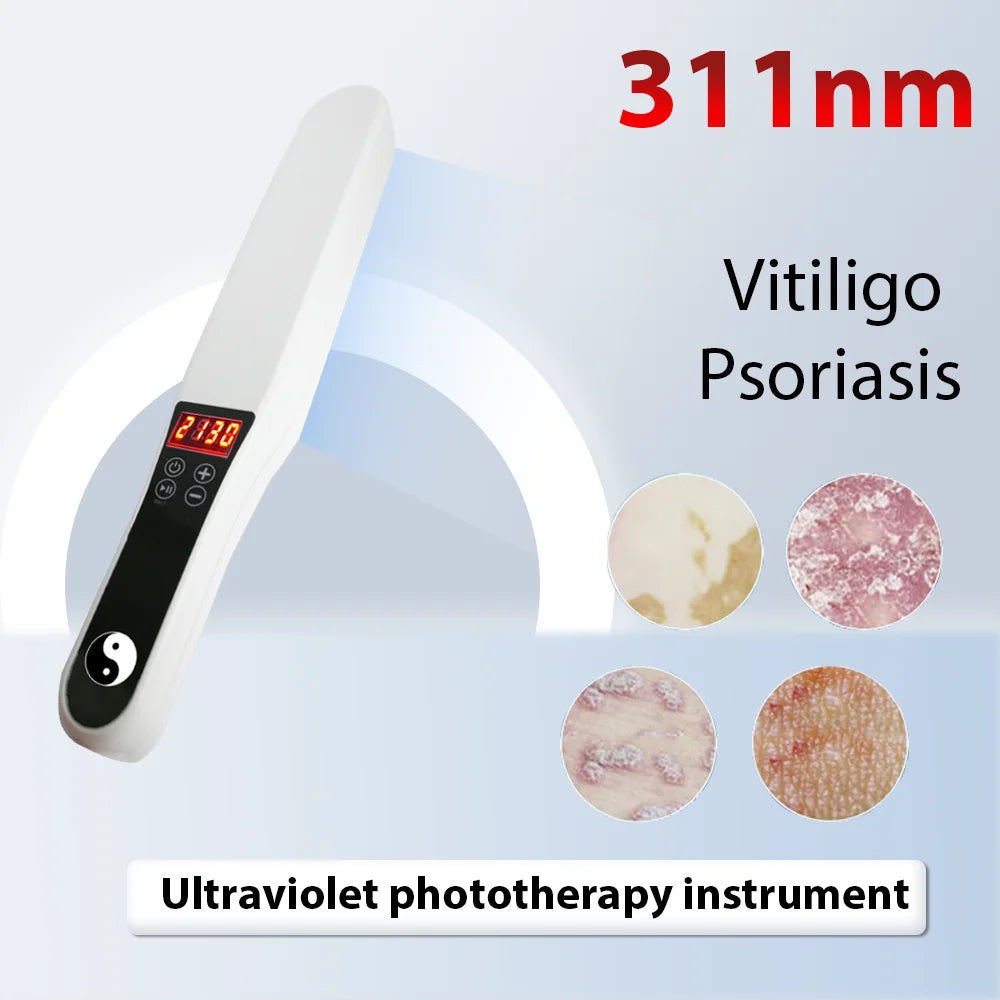 Portable 311nm UVB Phototherapy Device for Skin Treatment