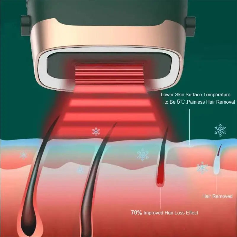 Portable IPL Hair Removal Epilator with 9 Intensity Levels & Auto Mode Add 3 Lamp
