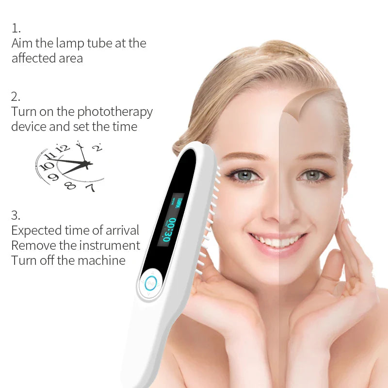 Home Use 311nm UVB Light Therapy Device 220V AU Plug