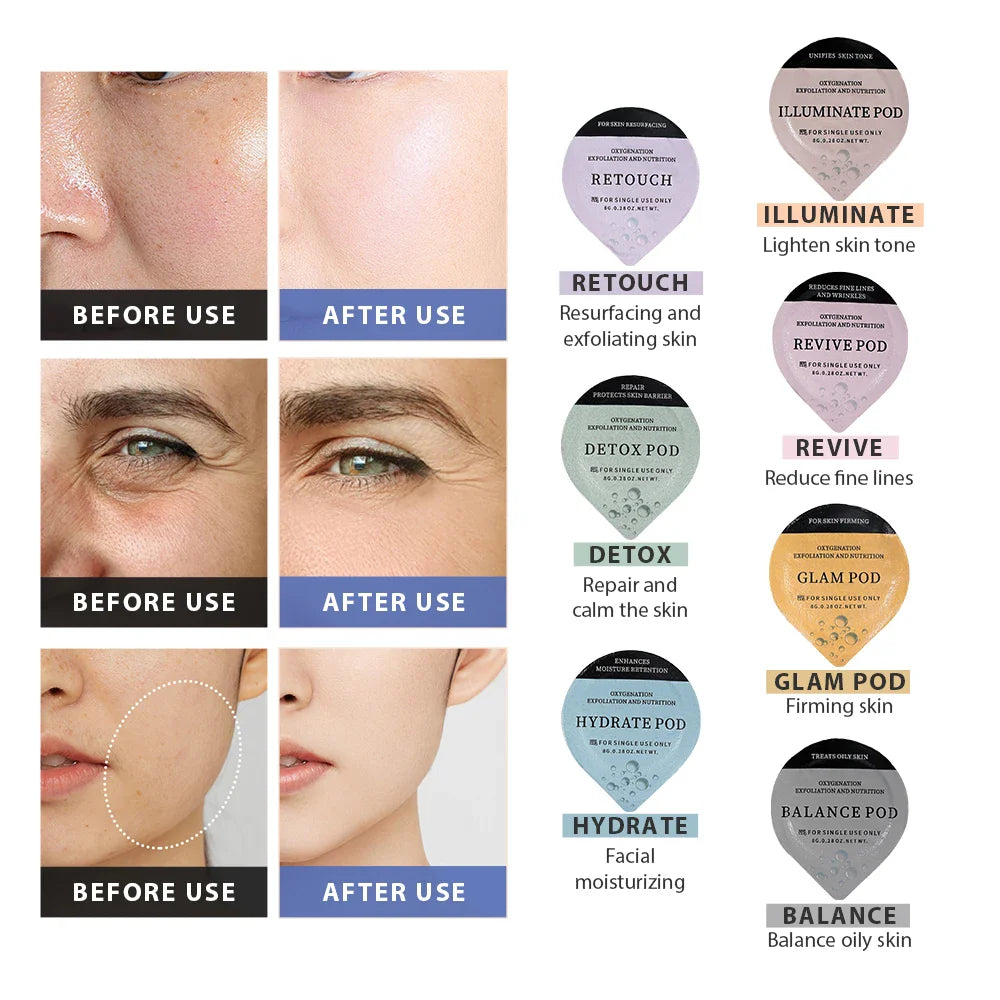 CO2 Oxygen Facial Pen with 7 Glam Pod Treatments