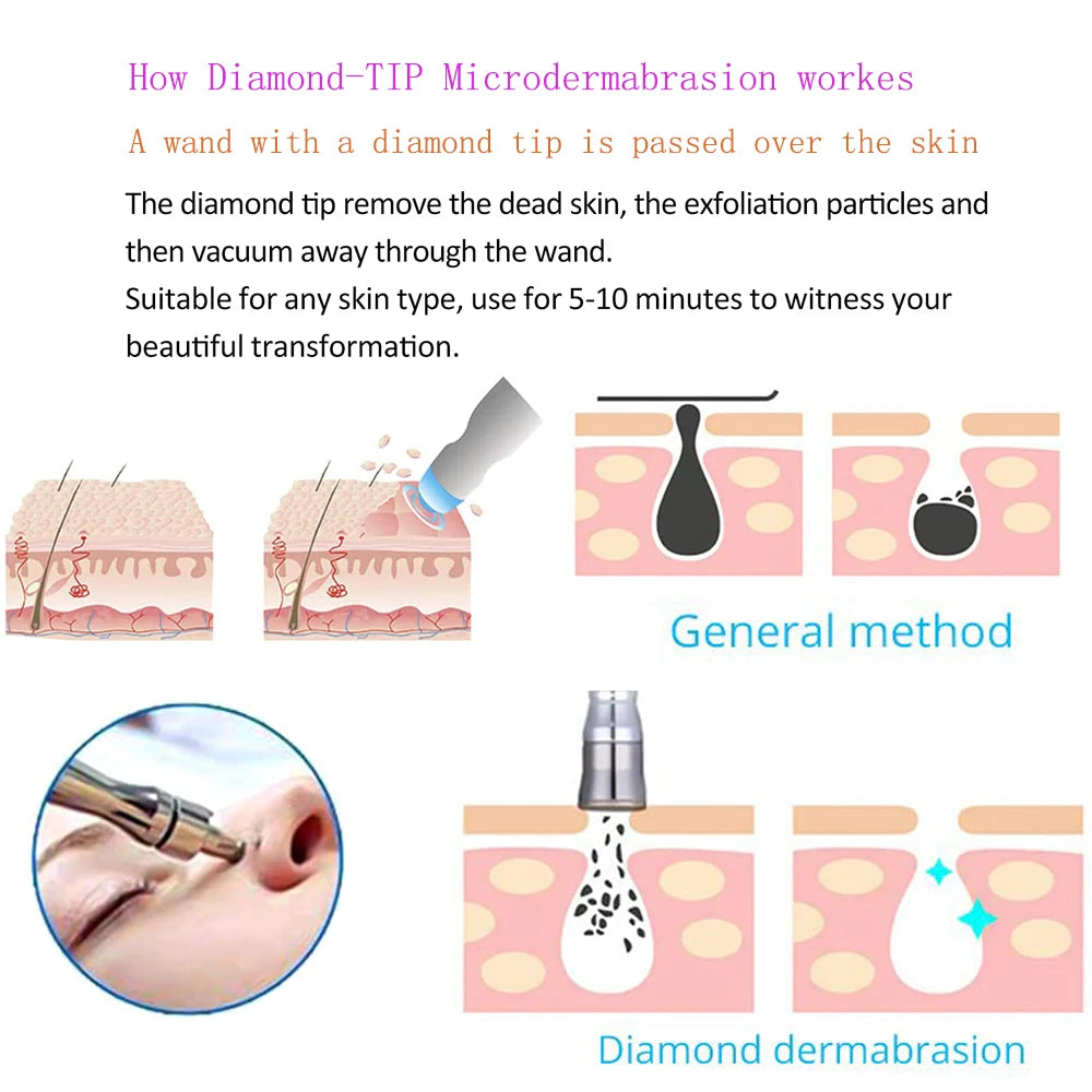 3-in-1 Diamond Microdermabrasion Vacuum Machine for Home Facial Skin Rejuvenation
