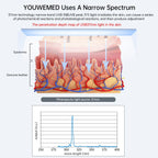 UVB Phototherapy Device for Home Skin Care Relief