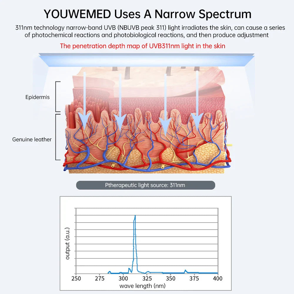 UVB Phototherapy Device for Home Skin Care Relief