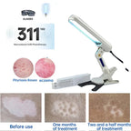 Rechargeable UVB 311nm Skin Treatment Lamp Home Light Therapy for Psoriasis AU Plug