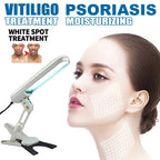 Home UVB Light Therapy Lamp Portable 311nm Device for Psoriasis, Eczema, Dermatitis Treatment White