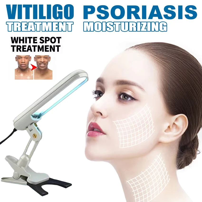 Home UVB Light Therapy Lamp Portable 311nm Device for Psoriasis, Eczema, Dermatitis Treatment White