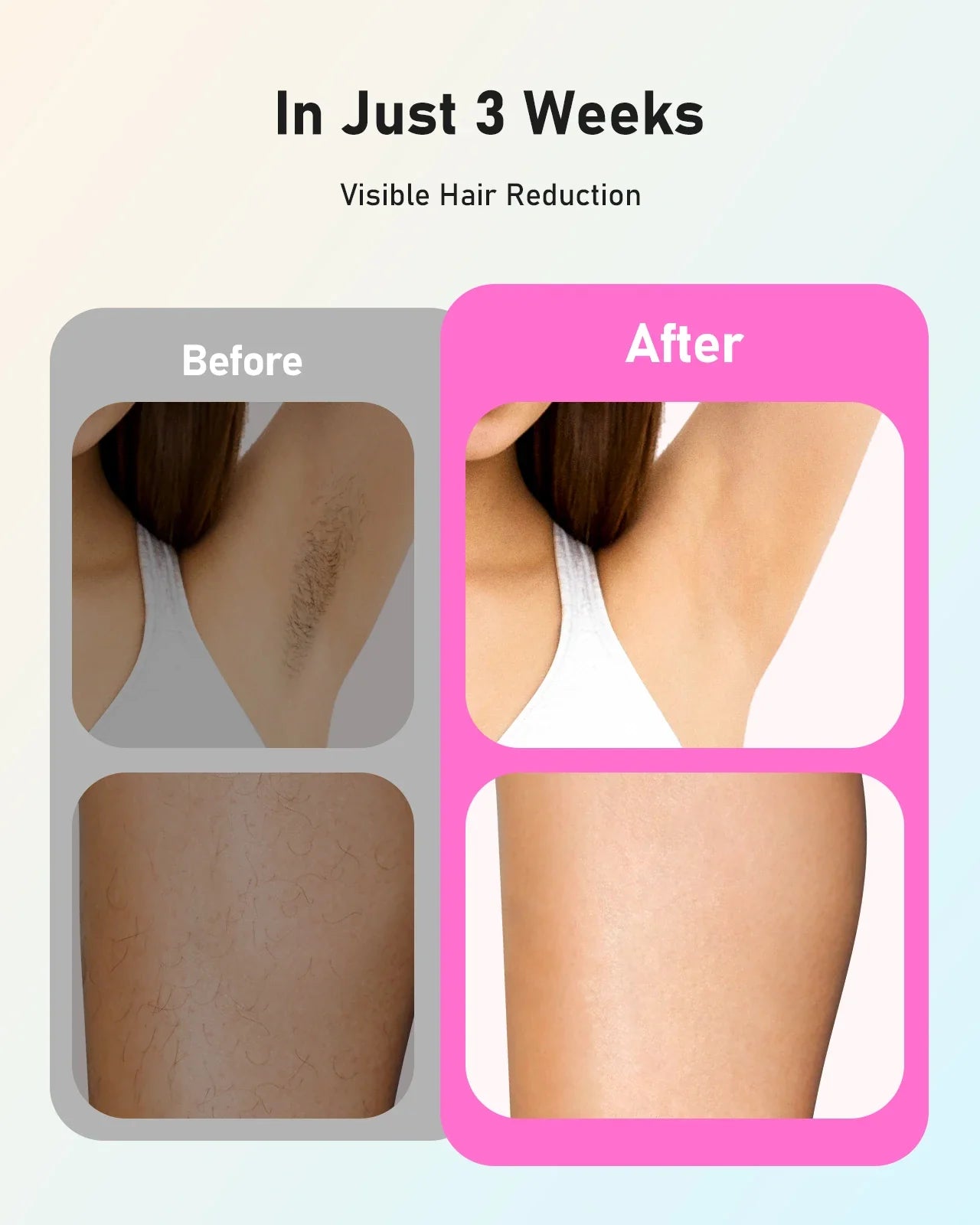 Home IPL Hair Remover 9 Levels Painless White