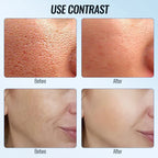 LED Facial Massager White with Box – Hot & Cold Skin Tightening Tool