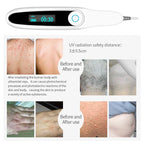 Home Use 311nm UVB Light Therapy Device 220V AU Plug
