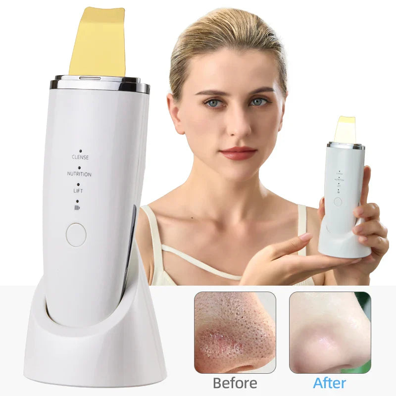Silver Head Facial Scrubber Ultrasonic Blackhead Remover