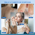 Portable 311nm UVB Phototherapy Device for Skin Treatment