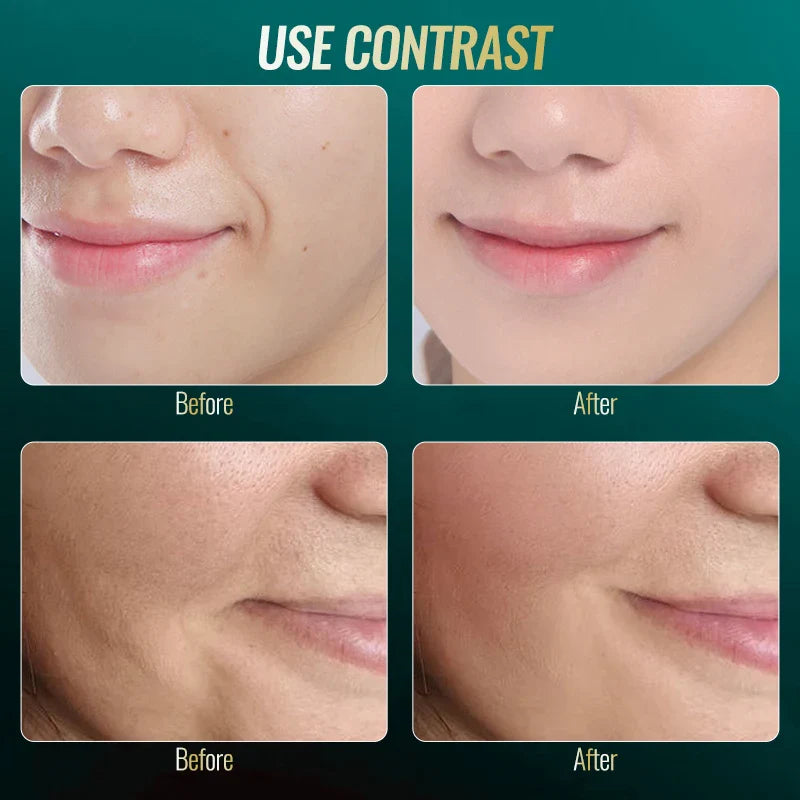 Hot & Cold EMS Face and Neck Massager for Skin Firmness