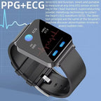 1.72" AMOLED Smartwatch with ECG and Blood Sugar Monitor