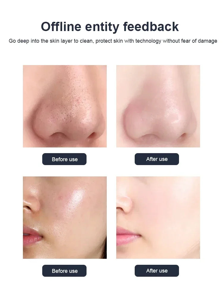 10-in-1 Hydrofacial Machine with Oxygen Peeling & Moisturizer