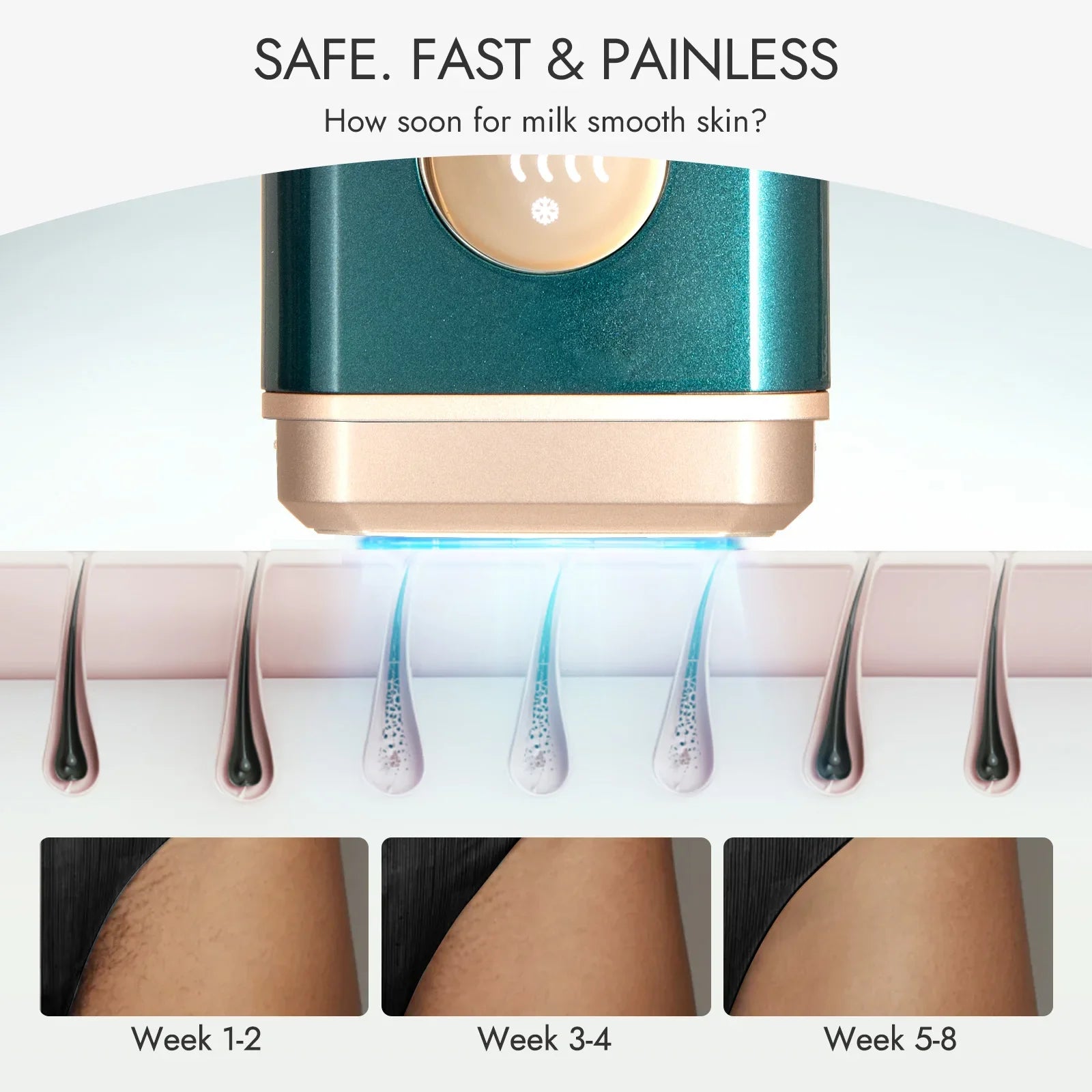 Rechargeable Mini Epilator for Face & Body Hair Removal - HR-515 GN