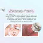 Corded 4-in-1 Face Peeling & Exfoliation Device with Water Spray – AU Plug