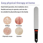 Portable 311nm UVB Phototherapy Device for Skin Treatment
