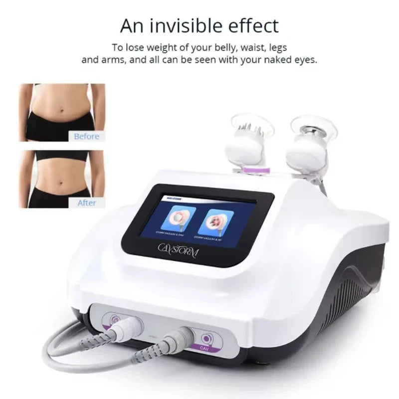 220V Ultrasonic RF Body Slimming Machine for Home Use