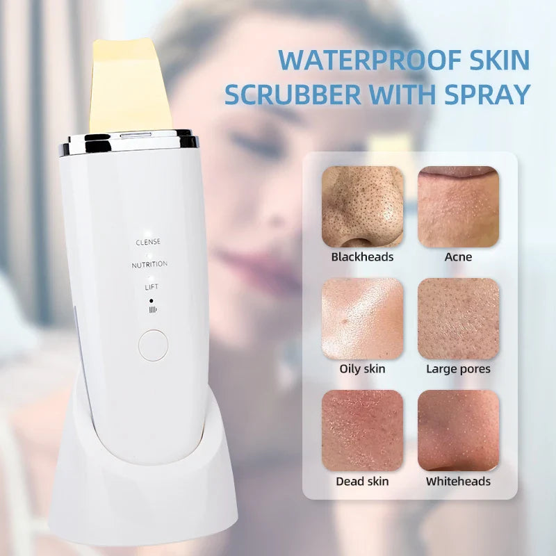 Gold Head Facial Scrubber Ultrasonic Blackhead Remover
