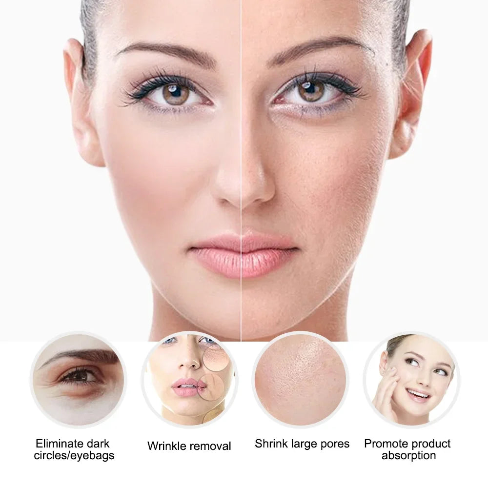 Portable Cryotherapy Skin Tightening Machine with LED Therapy