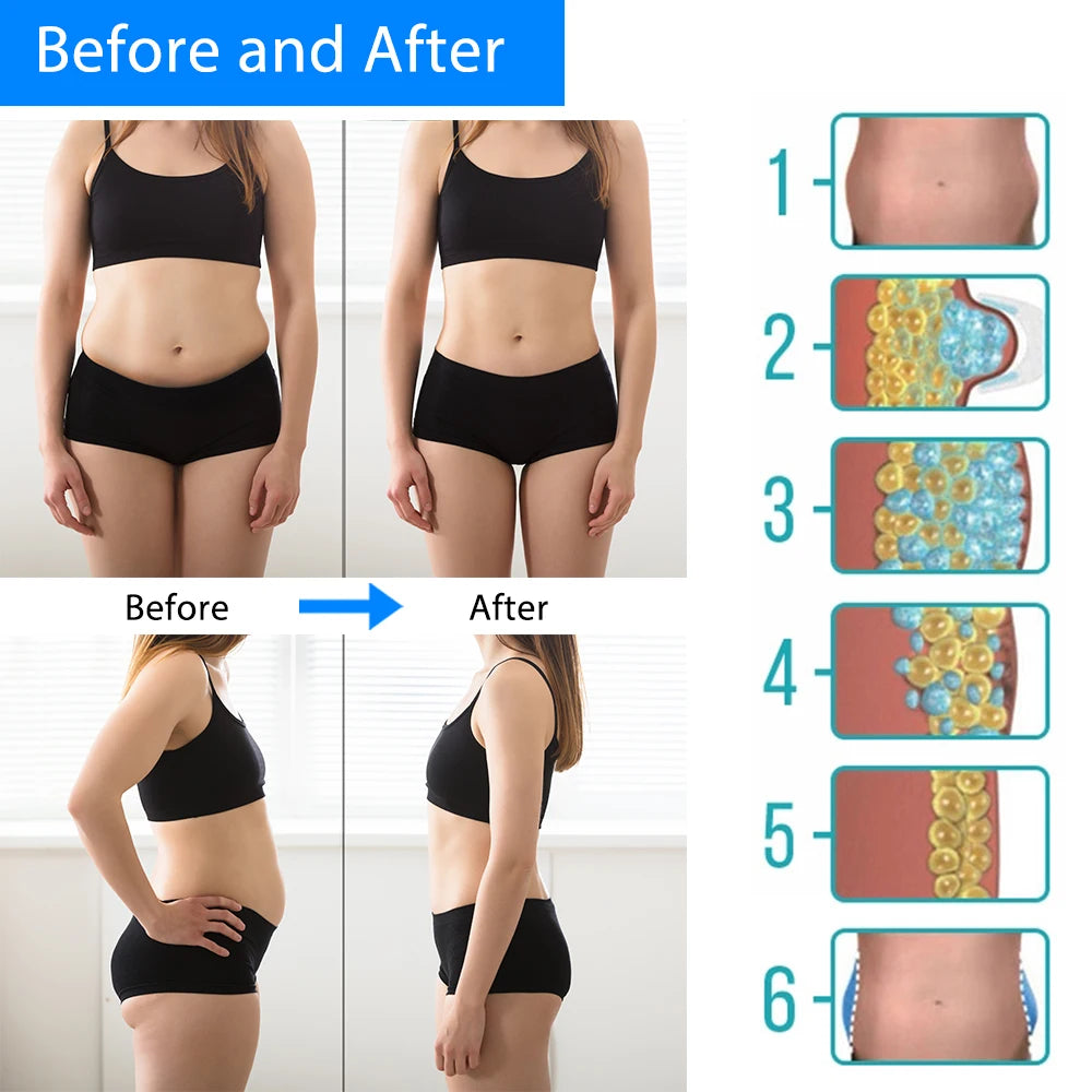 Portable Fat Freezing Slimming Machine for Body Contouring – At-Home Cryotherapy Device