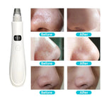 Electric Blackhead Remover Vacuum Cleaner With Box
