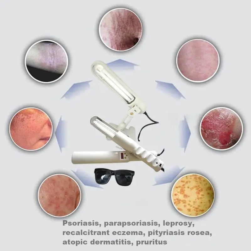 Rechargeable UVB 311nm Skin Treatment Lamp Home Light Therapy for Psoriasis AU Plug