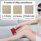 Home IPL Hair Removal Device 500K Flashes Rechargeable