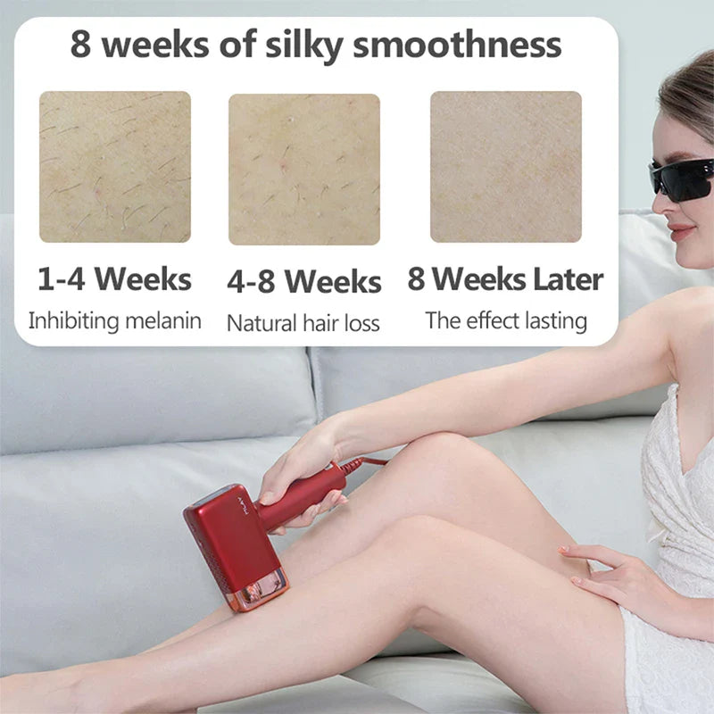 Home IPL Hair Removal Device 500K Flashes Rechargeable