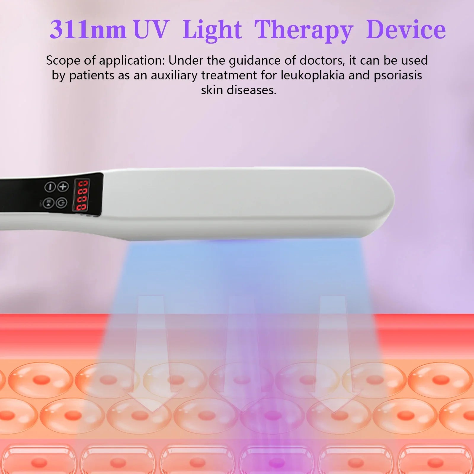 Portable 311nm UVB Phototherapy Device for Skin Treatment
