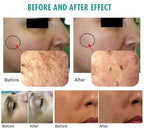 2-in-1 CO2 Oxy Facial Machine for Skin Rejuvenation