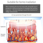 Home Use 311nm UVB Light Therapy Device 220V AU Plug