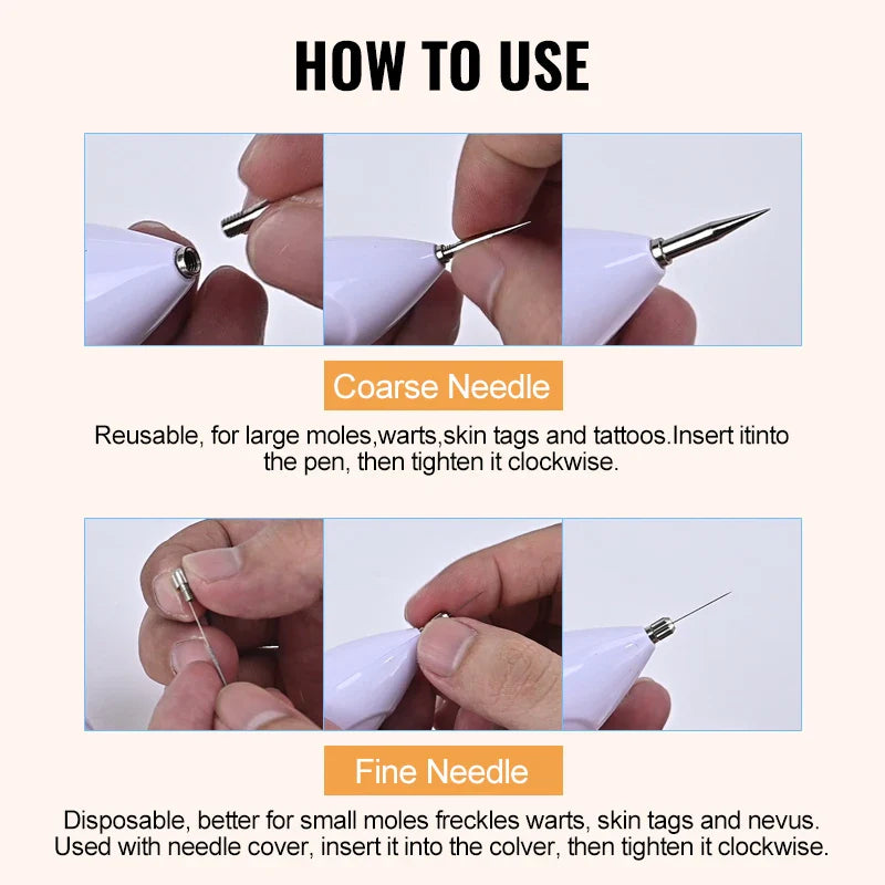 Mini Laser Plasma Mole Remover Pen with Box – Skincare Tool