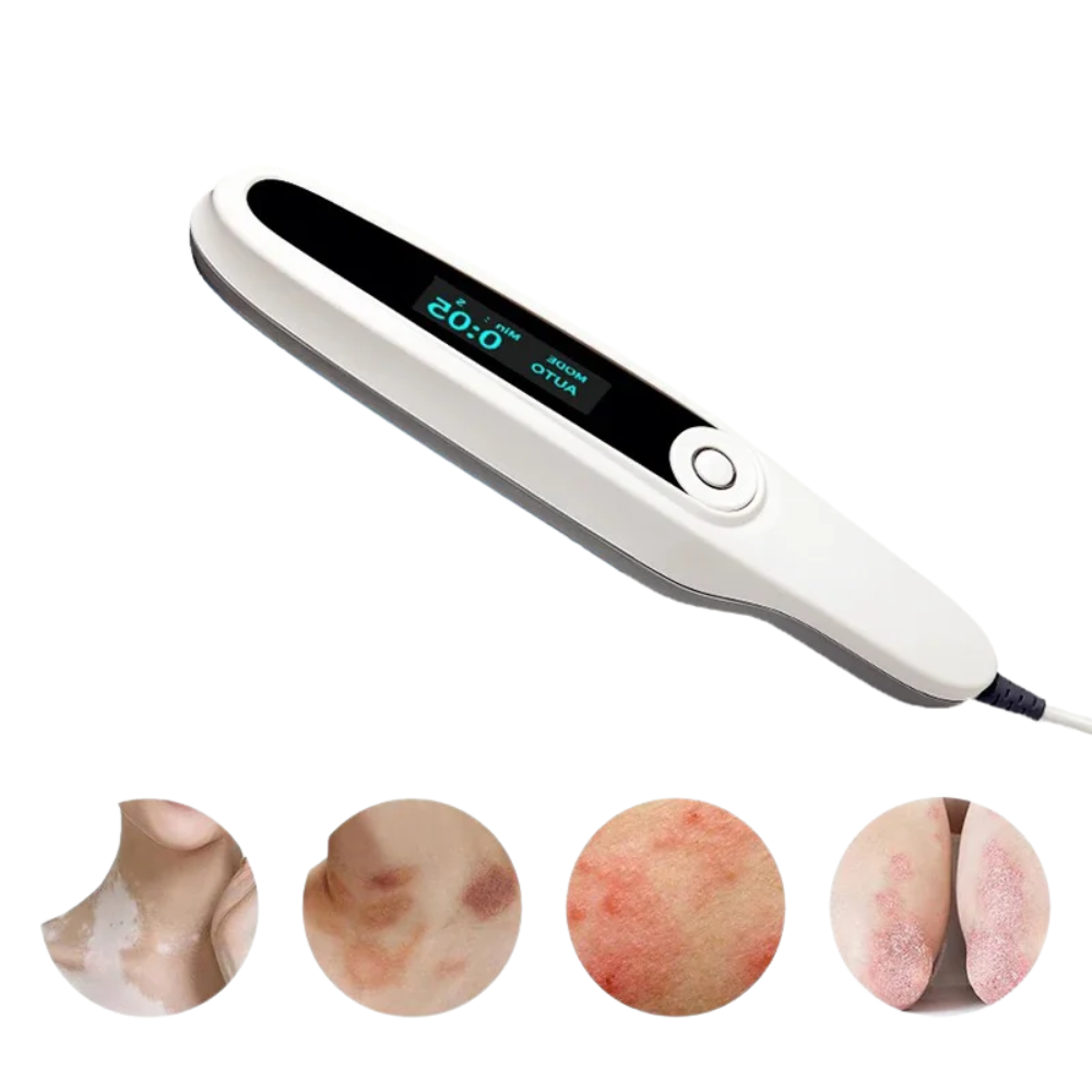311nm UVB Phototherapy Lamp Corded Home Use Skin Treatment Light, 220V